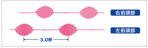 システム構成図と超音波振動波形